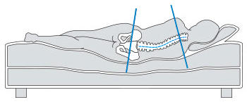 Как выбрать ортопедический матрас при боли в спине